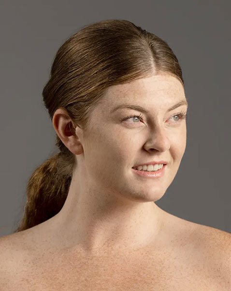 Condition based skin